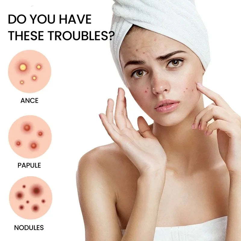 400pcs Star Acne Patches