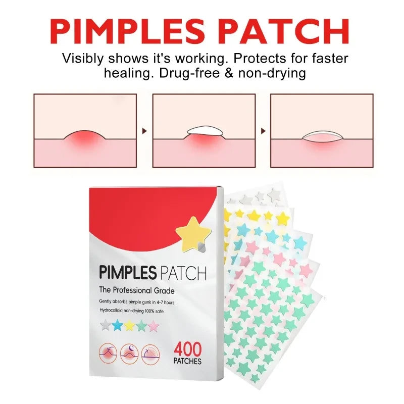 400pcs Star Acne Patches