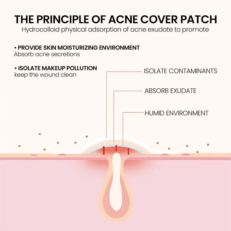 400pcs Star Acne Patches