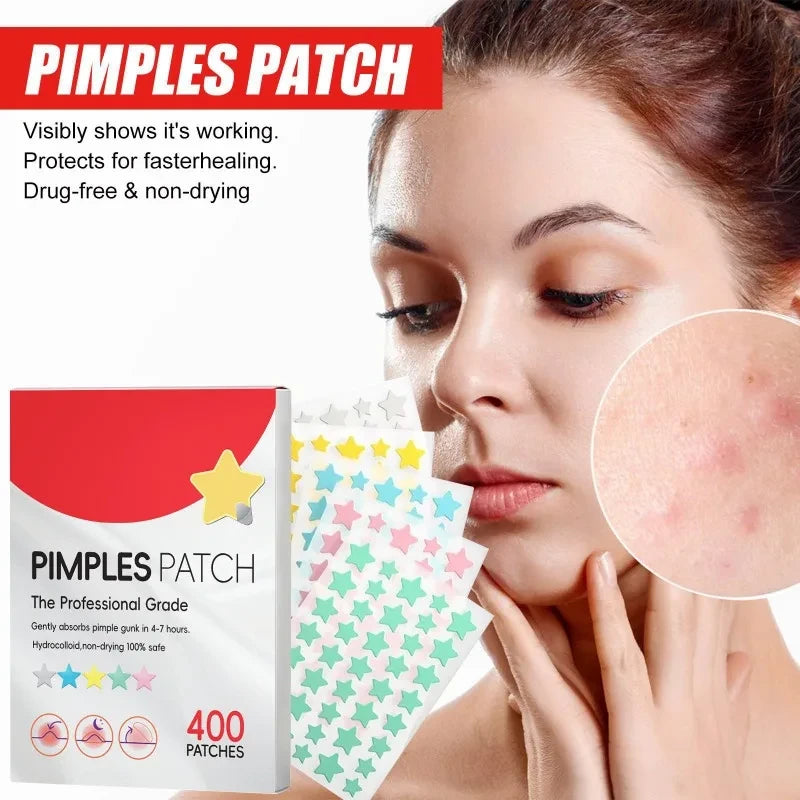 400pcs Star Acne Patches